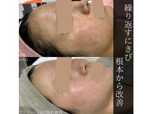 アウラプラス(Aura+)の雰囲気(静岡No.1/年間約1000人の肌管理を行っている実績多数サロン)
