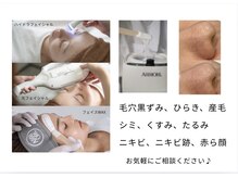 ラナ ビューティー(LANA beauty)