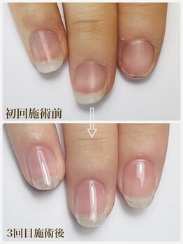 ラピスネイル(Lapis Nail)の写真/爪の健康を第一に考え、手足の爪のお悩みに寄り添い指先から自信に変わる場所