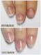 ラピスネイル(Lapis Nail)の写真/爪の健康を第一に考え、手足の爪のお悩みに寄り添い指先から自信に変わる場所
