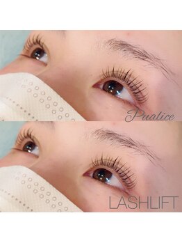 ピュアリス(Pualice)/ラッシュリフト