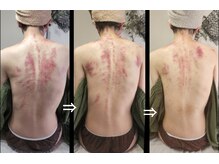 オアシス(OASIS)/ホット★カッサ