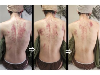 オアシス(OASIS)/ホット★カッサ