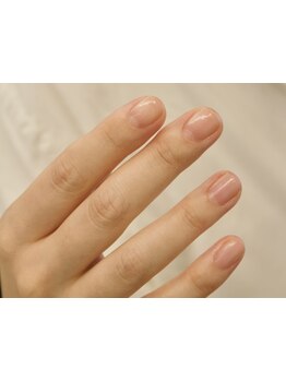 爪の悩みを解消できる（ケア含む）