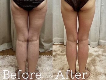 ヨサパーク ベル(YOSA PARK Belle)/結果にこだわるサロン！