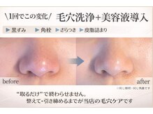 ソワン(Vi Soin)の雰囲気(肌質改善されたい方是非お試し下さい。)