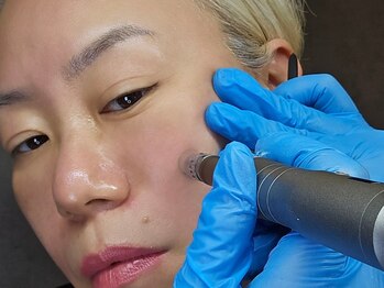 水光ピールスキンの写真/最先端の肌ターンオーバー速度。早いサイクルでシミ・しわ悩みをケアし、キメを整え若々しい印象の素肌へ。