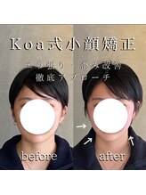 コア 中目黒店(Koa)/お客様ビフォーアフター！！