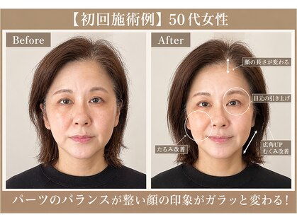 ラ アクサル(la.akthar)の写真
