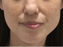 サロン ド アンジェリーナ(Salon de Angelina)/40代　お悩み改善！！