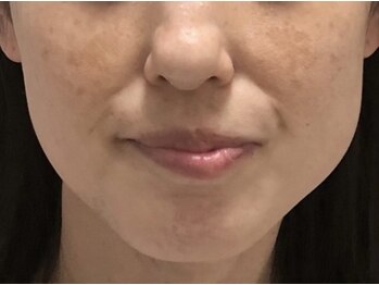 サロン ド アンジェリーナ(Salon de Angelina)/40代　お悩み改善！！