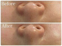 ブリエ(Briller)/シルクパウダー1回！