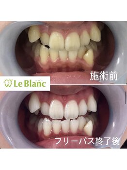 ルブラン 奈良店(Le Blanc)/食事制限ございません！