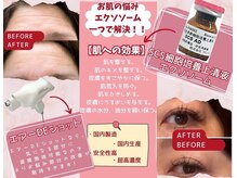 ミモア サロン(mimoa)の雰囲気（お肌の悩みエクソソーム1つで解決★）