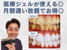 スマイルホワイト 赤羽店