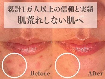 チェンジ(Change)