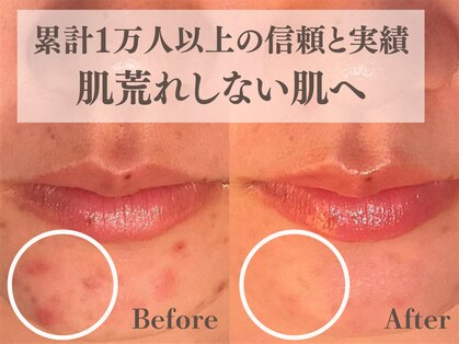 チェンジ(Change)の写真