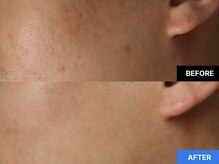 ギャラリー(GALLERY)/