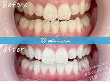 ホワイトニングカフェ 郡山店