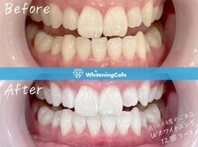 ホワイトニングカフェ 郡山店