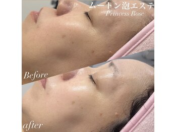 キレイシェア バイ プリンセスローズ静岡駅店(KIREI SHARE)/ムートン泡エステ