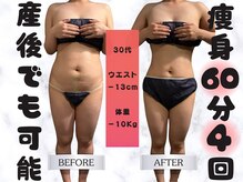 1週間に1回/60分施術を4回。ラジオ派/キャビテーション/吸引/EMS