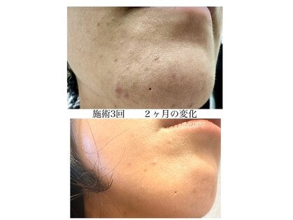 エミィシア(Emisia)の写真