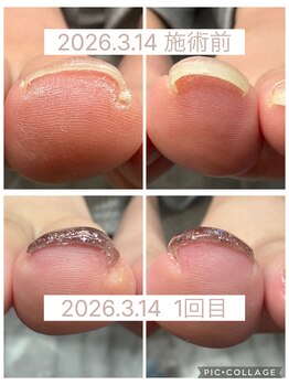 ブロックファイブハナ(Block 5 HANA)/