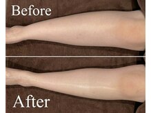 リフト 有楽町店(Re:ft)/疲れ・むくみ改善におすすめ！