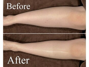 リフト 有楽町店(Re:ft)/疲れ・むくみ改善におすすめ！