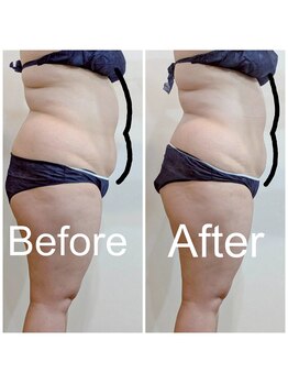 エミナル(EMINAL)/60分のウィンバック効果 お腹