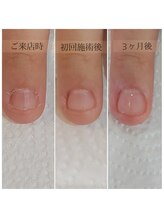 ピピ(PiPi)/