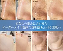 ルポ 鶴見(Repos)