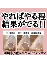 ゴールデンケア(goldencare)/続ける程に毛穴は変わる