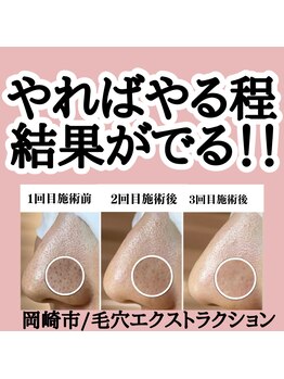 ゴールデンケア(goldencare)/続ける程に毛穴は変わる