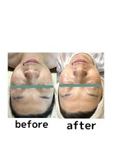 ビカム(become)/年齢肌に負けない！最新ケア！！