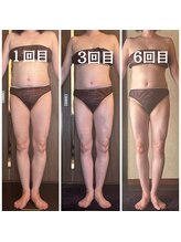 アーユルヴェーダアンドアロマエステ アユス(AYUS)/【50代】