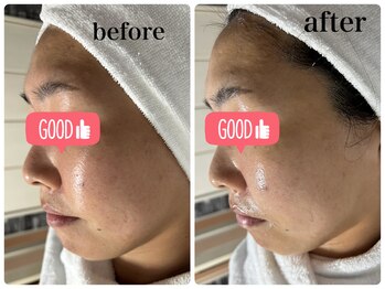 ニュウ(Nyu)/ララピール