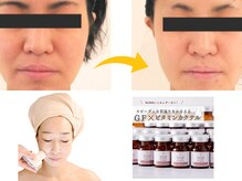 シェリー(CHERIE)/たるみケア ほうれい線 美白には