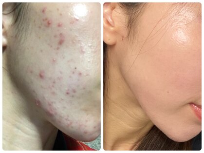 アリュール 京都烏丸御池店(ALLURE)の写真
