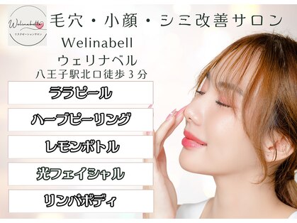 ウェリナベル(WelinaBelle)の写真