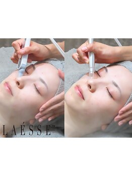 毛穴ケアをしたい