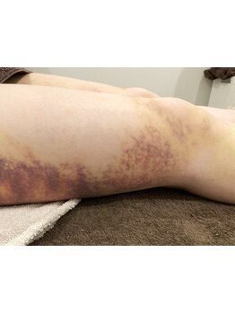 短期集中コースのあるサロン