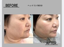 ネムリビト/ヘッドスパ80分