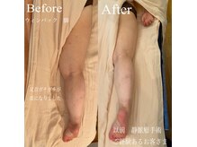 フセヤ &nbsp;エステティックアロマヨガスクール(FUSEYA)の雰囲気（熟練のマッサージ技術を岩盤浴マットやＷＩＮＢＡＣＫと◎）