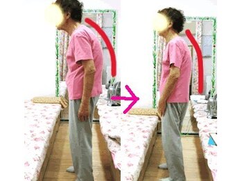 エスコート芦屋サロン/80代 女性 猫背 腰痛 肩こり