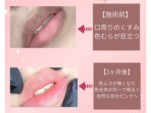 シエル(CIEL)の雰囲気（韓国発今話題の全身黒ずみケア/ドールピンク★）