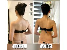 蒼(so)の雰囲気（一般的な整体や機器では解決できない側湾の方へ。『駆け込み寺』）