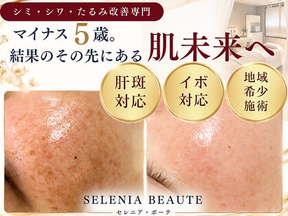 セレニア ボーテ(Selenia Beaute)の写真