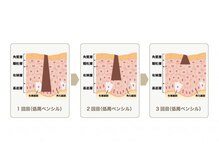 ハドゥ(Ha-DU)/シミケアの仕組み